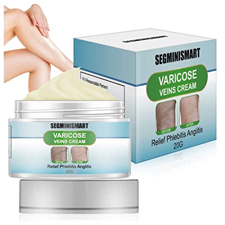 Varicose Veins Cream,Varicose Cream,Spider Veins Treatment Soothing Leg Cream Relief Blood Vein Veins Vasculitis Treatment