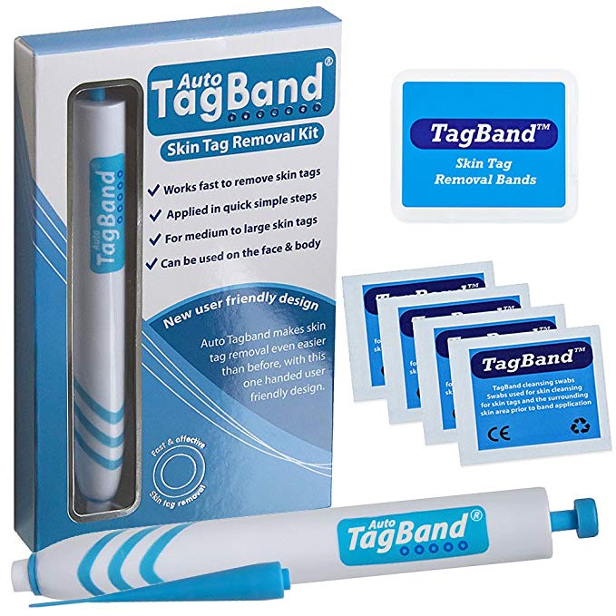 Auto TagBand Skin Tag Remover Device for Medium to Large Skin Tags