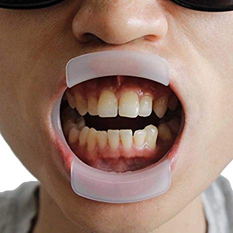 Melleco 10pcs Dental O Shape Oral Mouth Cheek Lip Retractor Opener Teeth Whitening Fun Game Tool