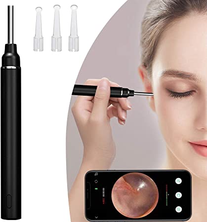 Ear Wax Removal Tool,Wireless Otoscope Earwax Remover Kit 1080P HD Camera Ear Wax Endoscope with LED Lights,Visual Ear Cleaner Ear Pick for Adults,Kids &Pets
