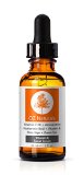 OZ Naturals - THE BEST Vitamin C Serum For Your Face - Organic Vitamin C  Amino  Hyaluronic Acid Serum- Clinical Strength 20 Vitamin C with Vegan Hyaluronic Acid Leaves Your Skin Radiant and More Youthful By Neutralizing Free Radicals This Anti Aging Serum Will Finally Give You The Results Youve Been Looking For - ALLURE MAGAZINES Best In Beauty Vitamin C Serum -100 Satisfaction GUARANTEED