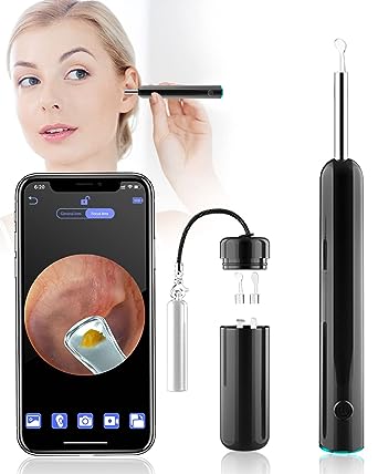 Otoscope,Ovifm HD 1080P Mini Endoscope Wifi 3,9Mm Nettoyage Oreille,Portable  Cam