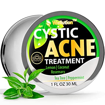 Cystic Acne Treatment and Acne Scar Remover - Made in USA - Effective Face & Body Severe Acne Cleanser with Tea Tree Oil - Prevent Future Breakouts - Natural Acne Spot Pimple Cream