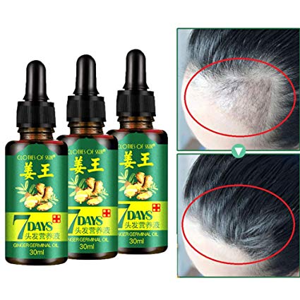 Ginger Germinal Oil 30ml 3pcs, Ginger Essential Oil Hair Growth Hair Loss Treatment Hair Growth Serum