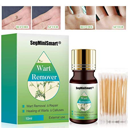 Wart Remover, Stops Wart Regrowth, Wart Removal, Painlessly Removes Common and Plantar Warts