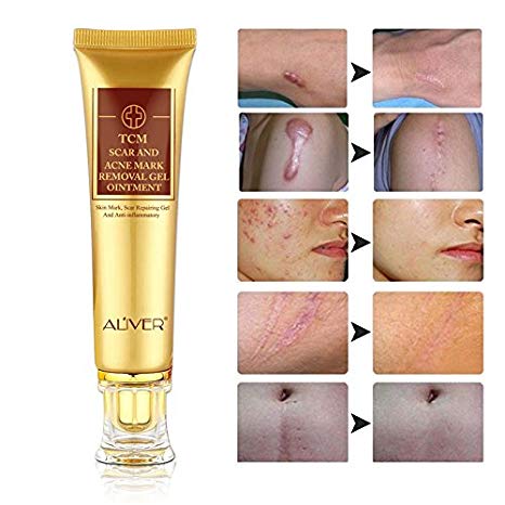 Scar Removal Cream - (2 Pack) TCM Scar and Acne Marks Removal Gel Ointment, Skin Repair Scars Burns Cuts Pregnancy Stretch Marks Acne Spots Skin Redness Treatment Cream for Face and Body
