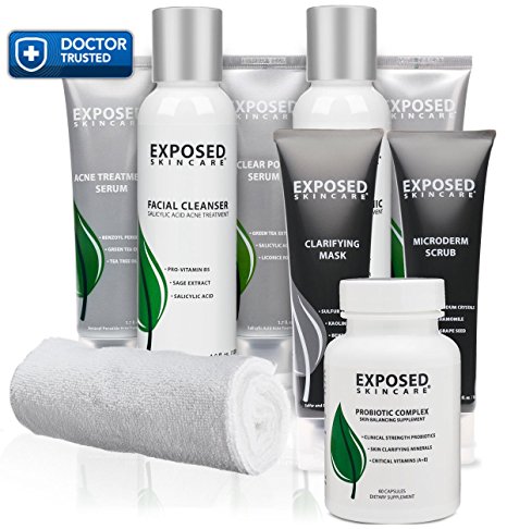 Exposed Acne Treatment: Ultimate Kit -- The BEST acne treatment skin care system to eliminate pimples and heal your skin.