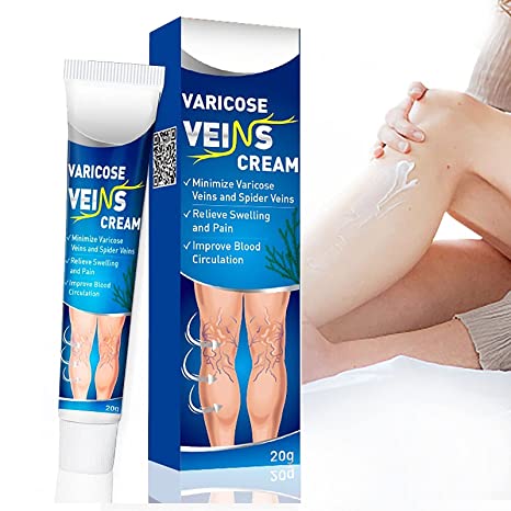 Varicose Veins Cream, Minimize Varicose Veins and Spider Veins for Legs, Relieve Swelling and Pain, Improve Blood Circulation