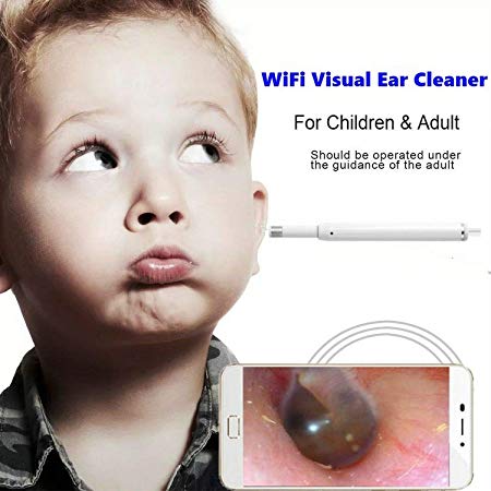 ICARINUS Portable WiFi Visual Ear Cleaner,Earwax Removal Tool Kit,Ear Wax Cleaner,Earwax Remover Soft Prevent Ear Pick Clean Tools Set for Adults Kids