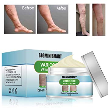 Varicose Cream,Varicose Veins Cream,Relief Phlebitis Angiitis Inflammation Blood Vein Veins Vasculitis Treatment Legs