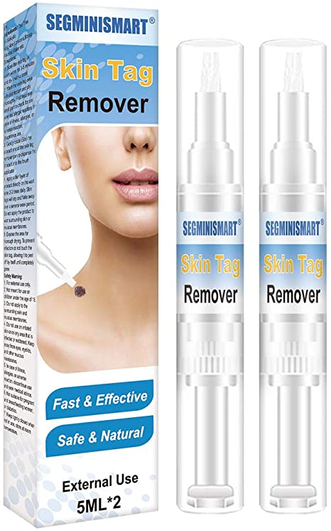 Skin Tag Removal,Mole Remover, Skin Tag Remover and Mole Remover