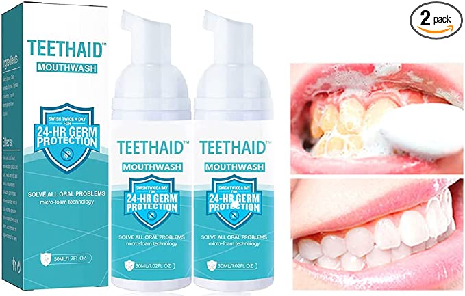 2Pcs Teethaid Mouthwash,Teeth Aid Mouthwash,Natural Teeth Whitening Foam Toothpaste,Calculus Removal Toothpaste,Deep Clean Fresh Breath Teeth Whitening Foam Cream Stain Remover