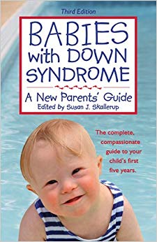Babies with Down Syndrome: A New Parents' Guide