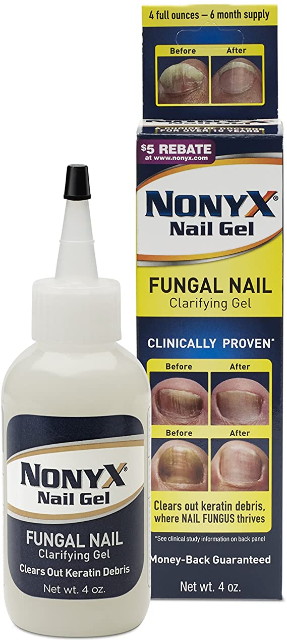 NonyX Nail Gel 4 oz (Pack of 5)
