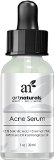 Art Naturals Anti Acne Serum Treatment 1 oz- Dermatologist Tested Product Made with Revolutionary Evermat and Organic Ingredients to Help Control and Get Rid of Acne - Best Pore Minimizer -For all Ages