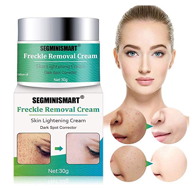 Freckle Cream,Dark Spot Corrector,Skin Lightening Cream,Freckle Remover,Bleaching Cream Freckle Removal Cream for Face and Body Hyperpigmentation Age Spot Freckles Melasma