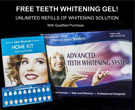 Advanced Teeth Whitening Kit with Unlimited Free Refills - Best Teeth Whitening at Home - Order Now RISK FREE
