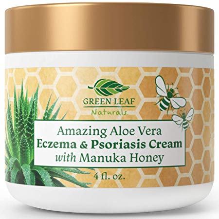 Amazing Aloe Vera Eczema and Psoriasis Cream with Manuka Honey by Green Leaf Naturals - 4 oz
