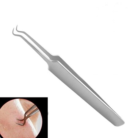 okdeals Bend Curved Blackhead Acne Blemish Clip Clips Pimple Comedone Remover Nipper Stainless Beauty Tools Face Cleaner