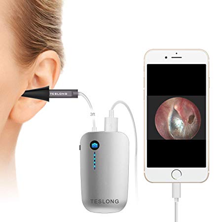 iPhone Otoscope, Teslong 720P HD USB Ear Canal Scope Eardrum Inspection Camera with Carrying Case for iPhone iPad iOS and Android Smartphone