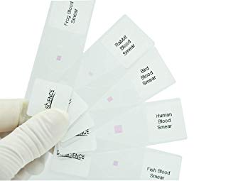 Prepared Human Animal Blood Smear Microscope Slides Set for Biology Science Education, Pack of 5pcs Different Kinds Specimens by DIY-SCIENCE