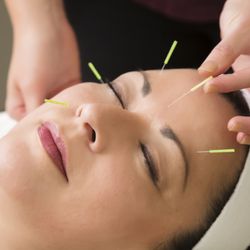 King’s Acupuncture
