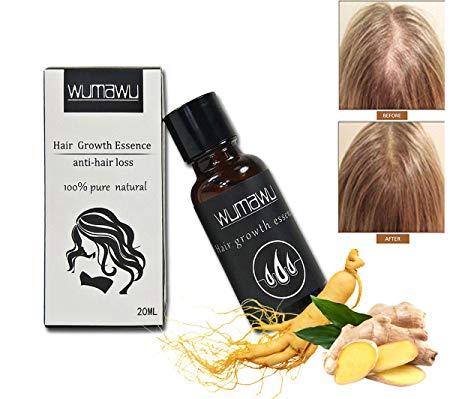 wumawu Hair Growth Essence,Hair Growth Liquid Help Hair Growing Fast Longer - Strengthens Hair Roots - Hair Loss & Hair Thinning Treatment