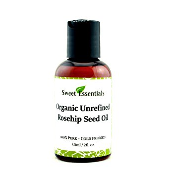 Organic Unrefined Virgin Rosehip Oil | 2oz Bottle | Premium 100% Pure | Imported From Chile | Cold-Pressed | HEALS Dry Skin, Fine Lines, Acne Scars, Eczema, Psoriasis, Dermatitis, Sun Damage & More