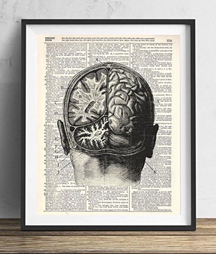 Human Brain Dissection Upcycled Dictionary Art Print 8x10