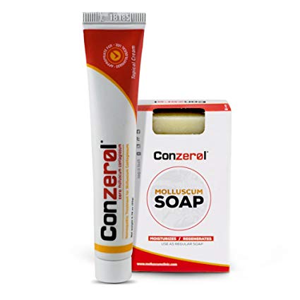 Stop Molluscum Today. Conzerol 2 Step Treatment for Molluscum Contagiosum. Painfree and Natural …