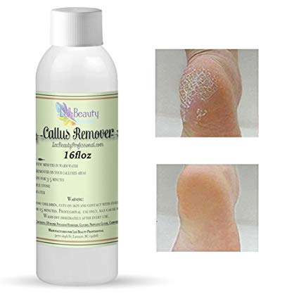 16oz Best Callus Remover.Callus Eliminator,Liquid & Gel For Corn And Callus On Feet. Professional Grade, Does Better Job Than Electric Shaver&Other Scary Tools