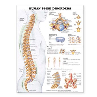 Human Spine Disorders