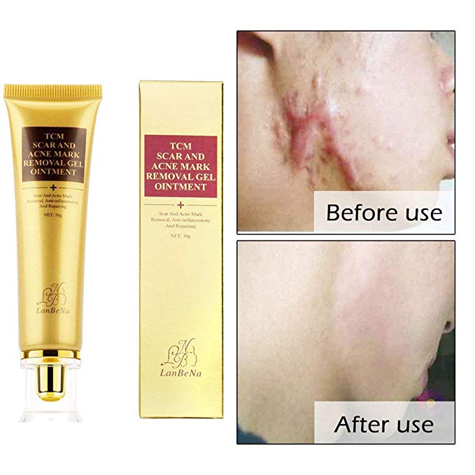 UniM Acne Scar Removal Cream for Repairing Acne Spots And Whitening-30g/Tube (1 PCS)