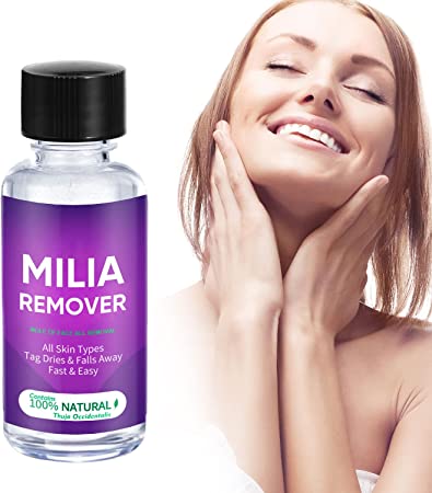 Milia Remover, Milia Spot Treatment Helps Dissolve and Reduce Milia, Syringomas, Cysts and Sebaceous Hyperplasia, Soften Skin