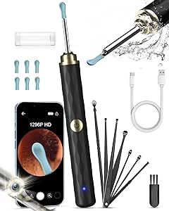 Kekoy Ear Wax Removal Kit Otoscope Ear Camera 1296P HD, WiFi Ear Cleaner with Camera, Rechargeable Ear Wax Remover Tool with Camera, Ear Wax Removal Tool with Lights for Adult & Kid(Black Gold)