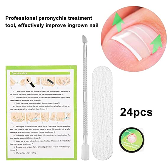 Professional Nail Correction Sticker,Pedicure Paronychia Recover Ingrown Toe Nail Manicure Clipper Fixer Special Pedicure Tools Foot CareTool Kit (24Pcs)