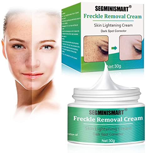 Freckle Cream,Skin Lightening Cream,Whitening Cream For Face,Brightening Cream,Bleaching Cream Freckle Removal Cream for Face Hyperpigmentation