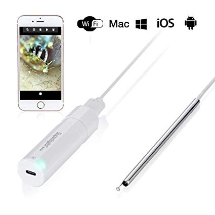 Supereyes Wireless WiFi Ear Otoscope Digital Ear Scope Curette | Ear Inspection Camera Earwax Cleansing Tool with LED Lights for Android iPhone iPad Mac Windows