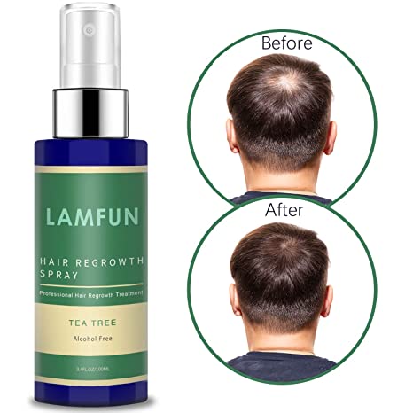 Hair Loss Treatment, LamFun Hair Growth Spray, 5% Minoxidil Topical Solution for Hair Loss, Shinning and Balding, For Men & Women, No Alcohol, Non-oily - 3.4FL OZ